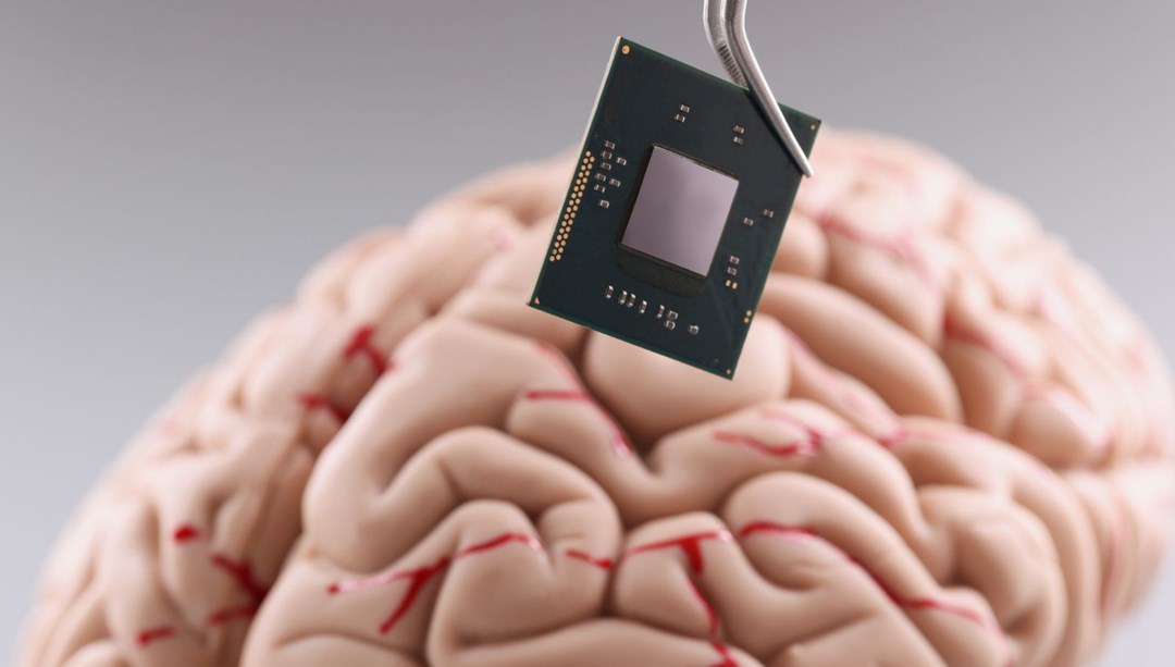 埃隆·马斯克分享：植入大脑芯片的病人用思维的力量下棋 - Last Minute 科技新闻